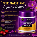 Creme Anti - rugas CONCENTRADO [COMPRE 1 LEVE 2] + Frete Grátis